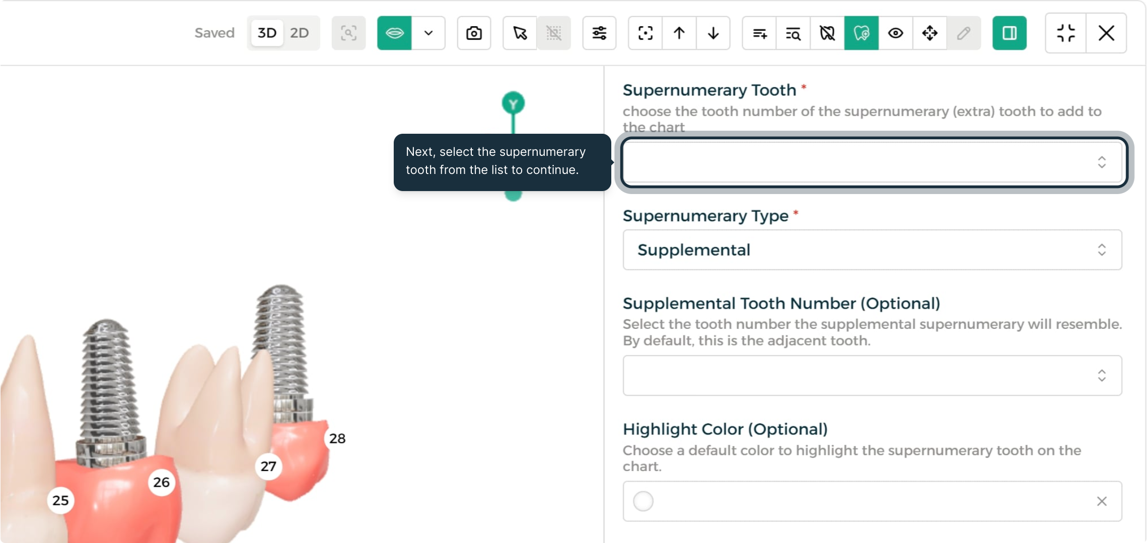 Step 2 - Select the supernumerary tooth position