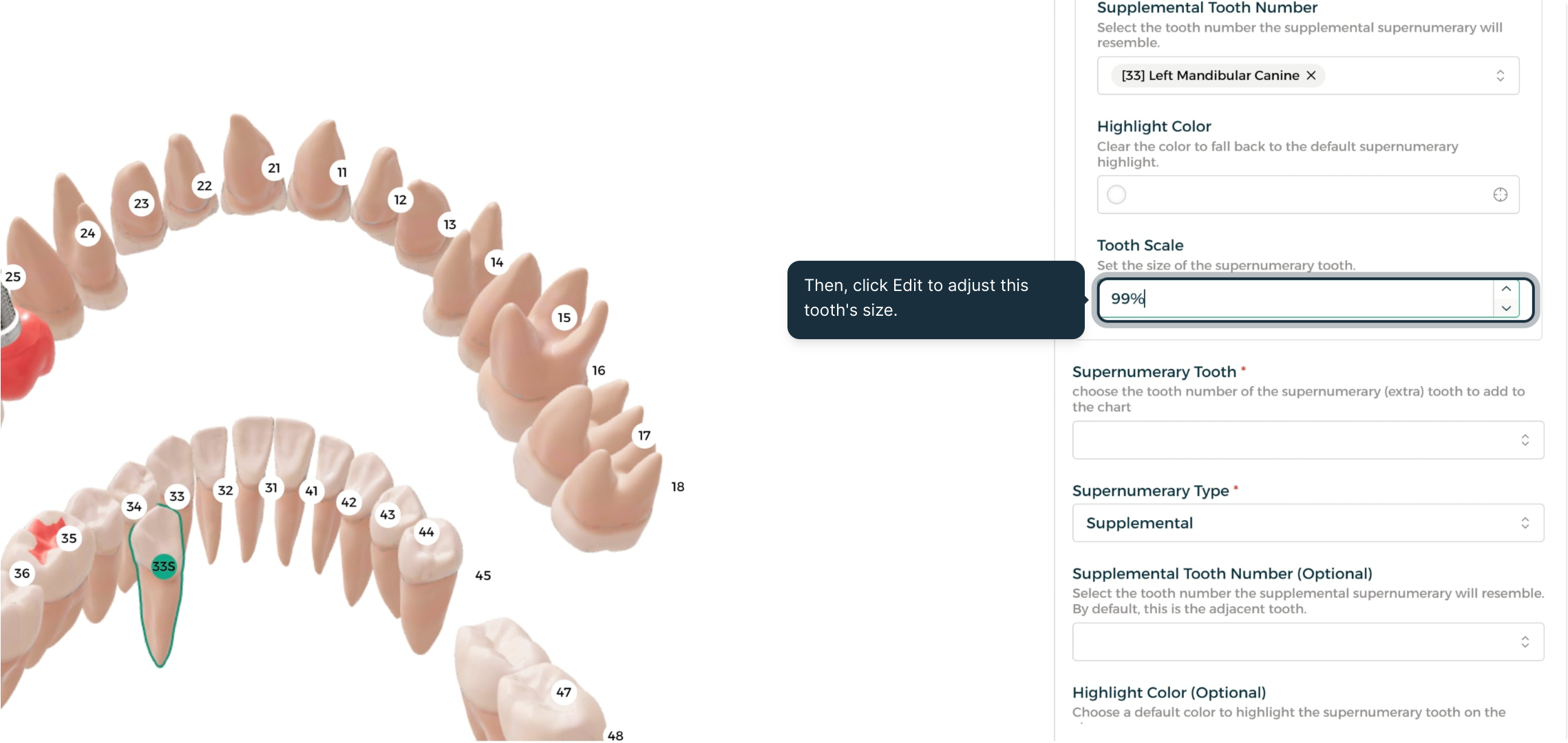 Step 1 - Adjust tooth size