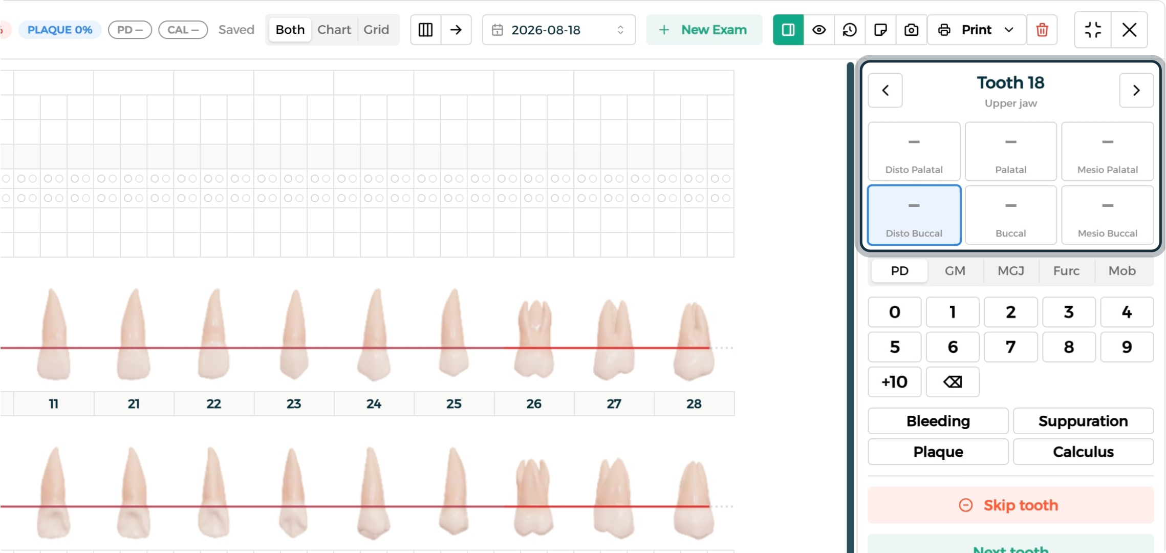 Step 1 - Tooth panel